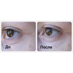 Тканевые патчи для области вокруг глаз с коллагеном PUREDERM Collagen Eye Zone Mask фото 3