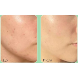 Пилинг-сборка для общения со спикулами и центелою Medipeel Phyto Cica-Nol B5 6000 Shot Serum фото 3
