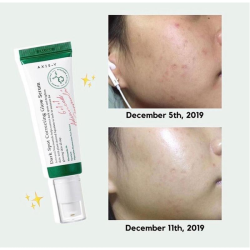 Сироватка для корекції темних плям Axis-Y Dark Spot Correcting Glow Serum фото 2