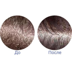 Очищающий пилинг-лосьон для кожи головы MASIL 12 Scalp SPA Cleansing Lotion фото 3
